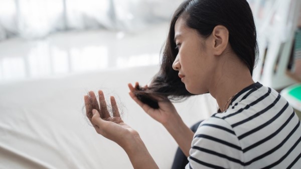 התקרחות נשית